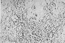 sluz nieprzenikalny pod mikroskopem